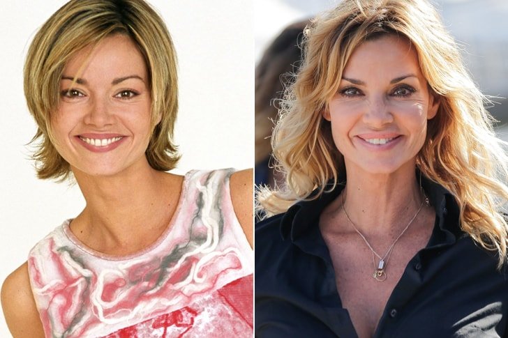 Ces stars Françaises ont toutes eu recours à la chirurgie esthétique et