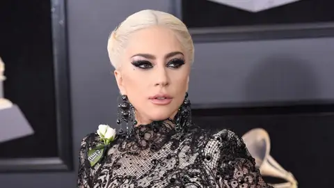 You Won’t Believe This Rare Car Hiding In Lady Gaga’s Garage!